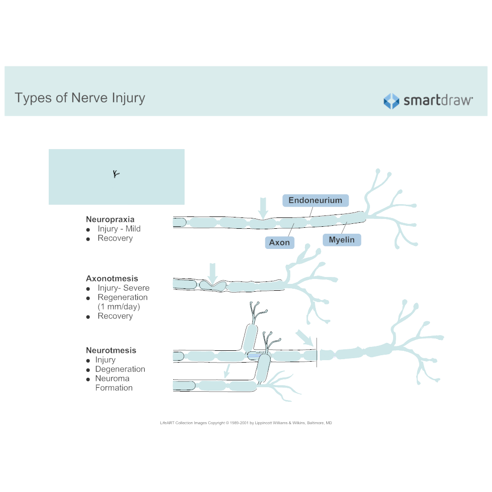  Types Of Nerve Injury 